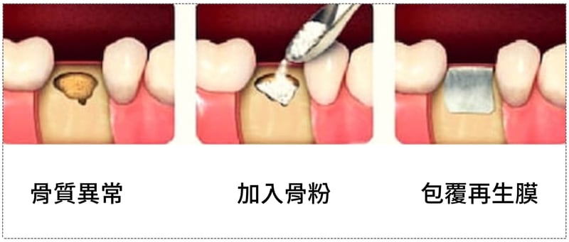 包覆再生膜
