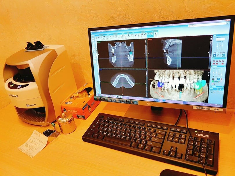 植牙過程3C電腦斷層
