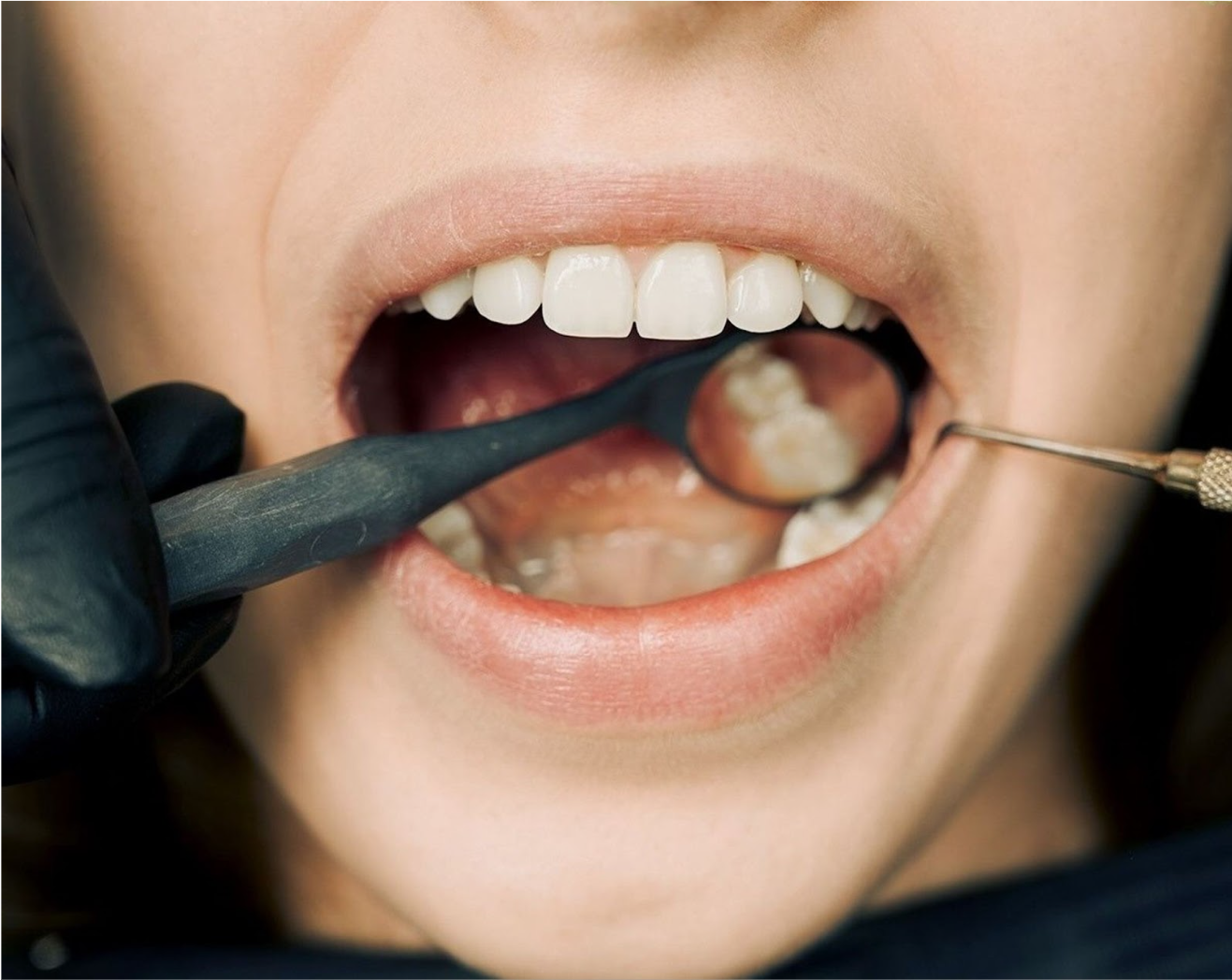 牙醫師檢查患者的牙齒與牙齦