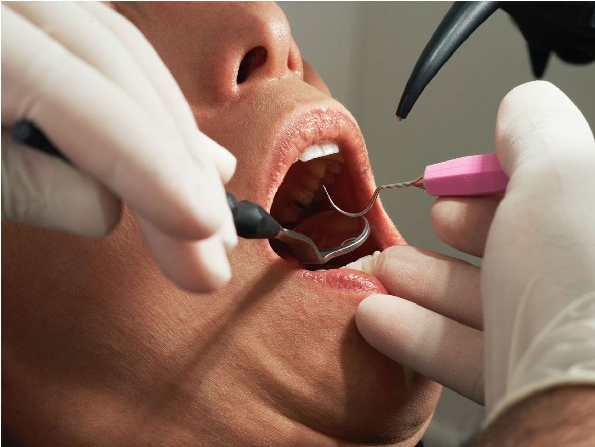 定期回診洗牙、進行完整口腔檢查，可提前預防牙周病