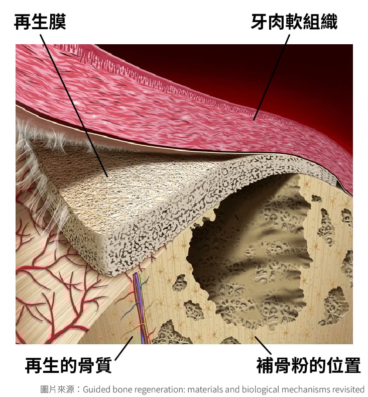 補骨粉情境示意圖