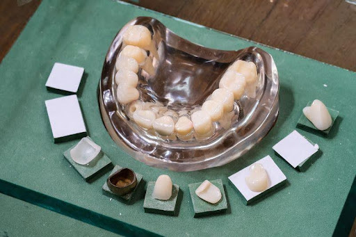 人本自然牙醫診所「數位技工室」擺出的各階段牙材