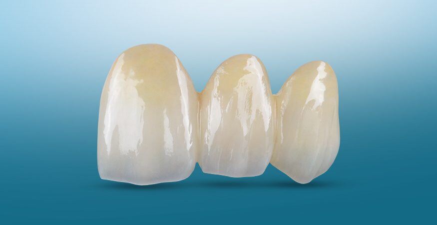 BruxZir-Esthetic-Solid-Zirconia-875x450-1-q1l8hc383r8q7nq4lzd2n2qw6y8bxavgugoz5bfqdw