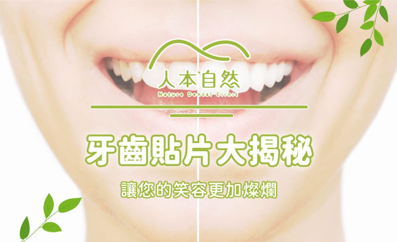 牙齒貼片大揭秘：讓您的笑容更加燦爛